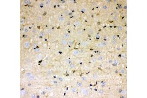 IHC analysis of DDAH1 using anti-DDAH1 antibody (ABIN4886560).