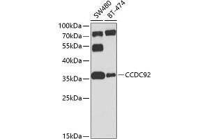 Western blot analysis of extracts of various cell lines, using CCDC92 antibody (ABIN6133294, ABIN6138046, ABIN6138047 and ABIN6224277) at 1:1000 dilution. (CCDC92 Antikörper  (AA 1-331))
