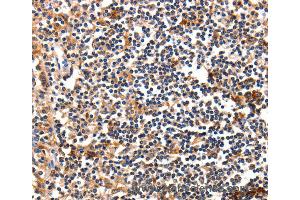 Immunohistochemistry of Human tonsil using FADD Polyclonal Antibody at dilution of 1:35