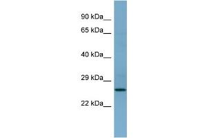 WB Suggested Anti-APIP Antibody Titration: 0. (APIP Antikörper  (Middle Region))