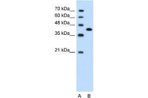WB Suggested Anti-CEACAM6 Antibody Titration:  1. (CEACAM6 Antikörper  (Middle Region))