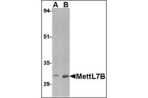 Western blot analysis of MettL7B in rat spleen tissue lysate with this product at (A) 2 and (B) 4 μg/ml. (METTL7B Antikörper  (C-Term))