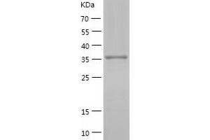 Western Blotting (WB) image for SHC (Src Homology 2 Domain Containing) Transforming Protein 1 (SHC1) (AA 161-474) protein (His tag) (ABIN7125084) (SHC1 Protein (AA 161-474) (His tag))