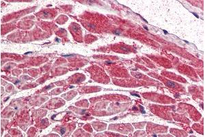 ABIN334459 (5µg/ml) staining of paraffin embedded Human Heart. (PIK3CA Antikörper  (Internal Region))
