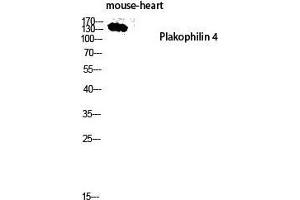 Western Blot (WB) analysis of Mouse Heart lysis using Plakophilin 4 antibody. (Plakophilin 4 Antikörper  (Internal Region))