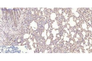Immunohistochemistry of paraffin-embedded Mouse lung tissue using Desmin Monoclonal Antibody at dilution of 1:200. (Desmin Antikörper)