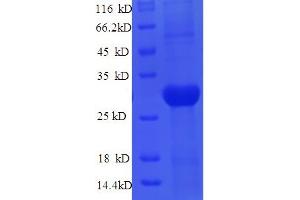 SDS-PAGE (SDS) image for Protein-Lysine 6-Oxidase (LYOX) (AA 163-411) protein (His tag) (ABIN5709867)