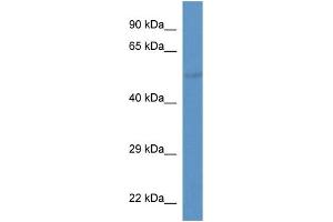 WB Suggested Anti-Slc37a2 Antibody   Titration: 1. (SLC37A2 Antikörper  (Middle Region))