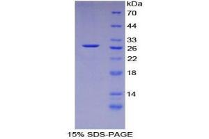 SDS-PAGE (SDS) image for Transforming Growth Factor, beta-Induced, 68kDa (TGFBI) (AA 423-632) protein (His tag) (ABIN2127060) (TGFBI Protein (AA 423-632) (His tag))