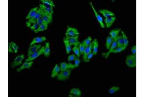 Immunofluorescence staining of HepG2 cells with ABIN7147110 at 1:66, counter-stained with DAPI.