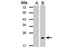 WB Image Western Blot analysis of DPT expression in transfected 293T cell line by DPT polyclonal antibody. (Dermatopontin Antikörper)