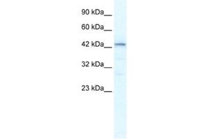 Western Blotting (WB) image for anti-SP140 Nuclear Body Protein-Like (SP140L) antibody (ABIN2461297) (SP140L Antikörper)