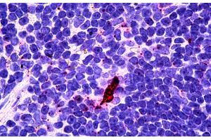 Human Lyphoid-Dendritic Cells: Formalin-Fixed, Paraffin-Embedded (FFPE) (EBI3 Antikörper)