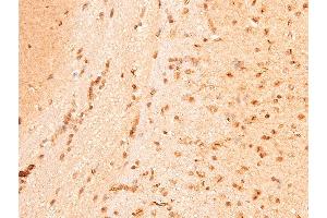 ABIN6267221 at 1/100 staining mouse brain tissue sections by IHC-P. (CHEK1 Antikörper  (pSer296))