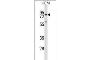 P16 Antibody (C-term) (ABIN657636 and ABIN2846632) western blot analysis in CEM cell line lysates (35 μg/lane). (MMP16 Antikörper  (C-Term))
