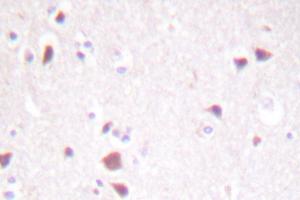 Image no. 1 for anti-Macrophage Stimulating 1 (Hepatocyte Growth Factor-Like) (MST1) antibody (ABIN272039) (MST1 Antikörper)