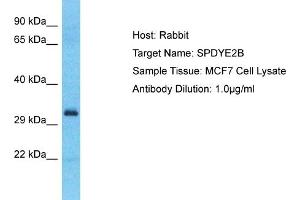 Host: Rabbit Target Name: SPDYE2B Sample Type: MCF7 Whole Cell lysates Antibody Dilution: 1. (SPDYE2B Antikörper  (C-Term))
