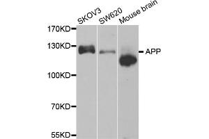 Western blot analysis of extracts of various cell lines, using APP antibody (ABIN5971616). (APP Antikörper)