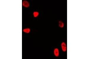 Immunofluorescent analysis of WDR5 staining in U2OS cells. (WDR5 Antikörper)