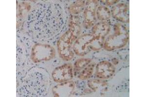 IHC-P analysis of Human Kidney Tissue, with DAB staining. (P2RX7 Antikörper  (AA 47-334))