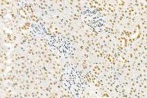 Immunohistochemistry (Paraffin-embedded Sections) (IHC (p)) image for anti-Pinin, Desmosome Associated Protein (PNN) antibody (ABIN7075083)