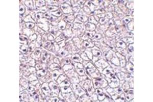 Immunohistochemistry of TSLP-R in human liver tissue with this product at 5 μg/ml. (CRLF2 Antikörper  (Center))