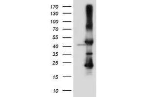 Western Blotting (WB) image for anti-serpin Peptidase Inhibitor, Clade B (Ovalbumin), Member 6 (SERPINB6) antibody (ABIN1500892) (SERPINB6 Antikörper)