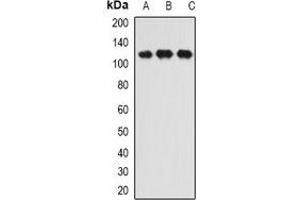 Western blot analysis of INTS6 expression in HL60 (A), SW620 (B), Hela (C) whole cell lysates.