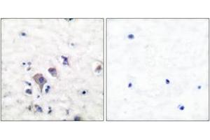 Immunohistochemistry analysis of paraffin-embedded human brain tissue, using mGluR2/3 Antibody. (mGluR2/3 Antikörper  (AA 823-872))