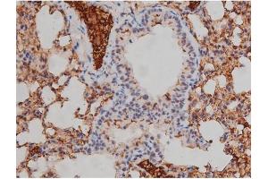 Immunohistochemistry (IHC) image for anti-V-Yes-1 Yamaguchi Sarcoma Viral Related Oncogene Homolog (LYN) (pTyr507) antibody (ABIN6256754)