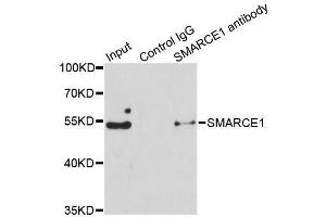 Immunoprecipitation (IP) image for anti-SWI/SNF Related, Matrix Associated, Actin Dependent Regulator of Chromatin, Subfamily E, Member 1 (SMARCE1) (AA 1-411) antibody (ABIN6148115)