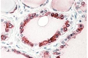 AP31571PU-N (5µg/ml) staining of paraffin embedded Human Thyroid Gland. (Thyroperoxidase Antikörper  (C-Term))