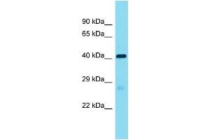 Host:  Rabbit  Target Name:  Lrrc19  Sample Type:  Mouse Heart lysates  Antibody Dilution:  1. (LRRC19 Antikörper  (Middle Region))