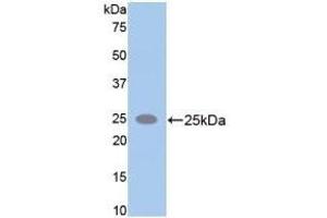 Detection of Recombinant SPTAN1, Rat using Polyclonal Antibody to Alpha-Fodrin (SPTAN1) (SPTAN1 Antikörper  (AA 2071-2269))
