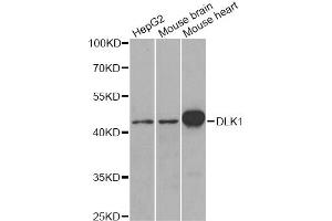 Western blot analysis of extracts of various cell lines, using DLK1 antibody. (DLK1 Antikörper)