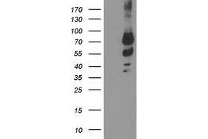 Western Blotting (WB) image for anti-Katanin P80 (WD Repeat Containing) Subunit B 1 (KATNB1) antibody (ABIN1498986) (KATNB1 Antikörper)
