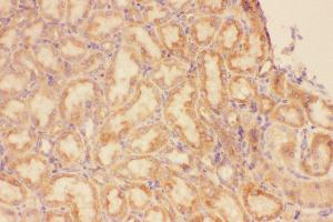Immunohistochemistry (IHC) image for anti-Chemokine (C-X-C Motif) Receptor 3 (CXCR3) (AA 1-368) antibody (ABIN3042780)