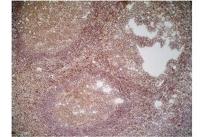 Immunoperoxidase staining of a human tonsil cryosection with Mouse anti Human CD70 antibody, clone Bu69 followed by the Histar setection system. (CD70 Antikörper)