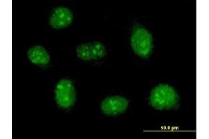 Immunofluorescence of purified MaxPab antibody to RBM41 on HeLa cell.