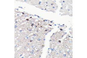 Immunohistochemistry of paraffin-embedded rat brain using NMDA Rabbit mAb (ABIN7267420) at dilution of 1:100 (40x lens). (NMDAR2A Antikörper)