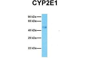 Host:  Rabbit  Target Name:  CYP2E1  Sample Tissue:  Human Fetal Lung  Antibody Dilution:  1. (CYP2E1 Antikörper  (C-Term))