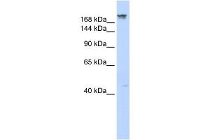 WB Suggested Anti-DYSF Antibody Titration:  0. (Dysferlin Antikörper  (Middle Region))
