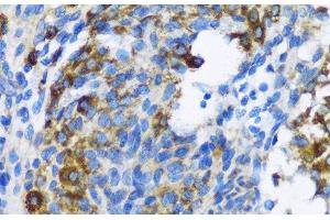 Immunohistochemistry of paraffin-embedded Rat ovary using PTCH1 Polyclonal Antibody at dilution of 1:100 (40x lens). (Patched 1 Antikörper)