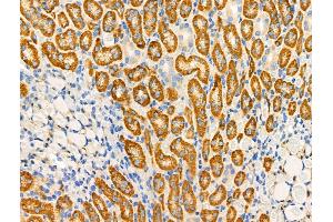 ABIN6259707 and ABIN6276744 at 1/100 staining Rat kidney tissue by IHC-P. (ABO Antikörper  (N-Term))