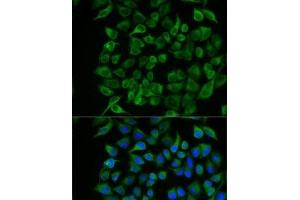 Immunofluorescence analysis of U2OS cells using PAEP Polyclonal Antibody (PAEP Antikörper)