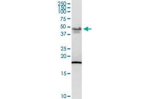 PCYT1B MaxPab rabbit polyclonal antibody. (PCYT1B Antikörper  (AA 1-369))