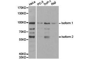 Western Blotting (WB) image for anti-Ubiquitin-Like with PHD and Ring Finger Domains 2, E3 Ubiquitin Protein Ligase (UHRF2) antibody (ABIN1875279)