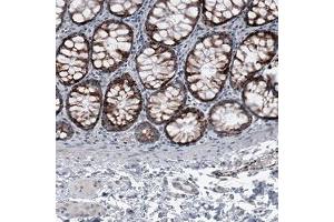 Immunohistochemical staining (Formalin-fixed paraffin-embedded sections) of human colon shows granular cytoplasmic positivity in glandular cells. (OTC Antikörper)