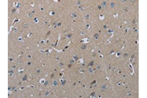 The image on the left is immunohistochemistry of paraffin-embedded Human brain tissue using ABIN7129423(FAAH Antibody) at dilution 1/50, on the right is treated with fusion protein.