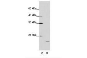 Image no. 1 for anti-Interferon Stimulated Exonuclease Gene 20kDa (ISG20) (AA 35-84) antibody (ABIN202043) (ISG20 Antikörper  (AA 35-84))